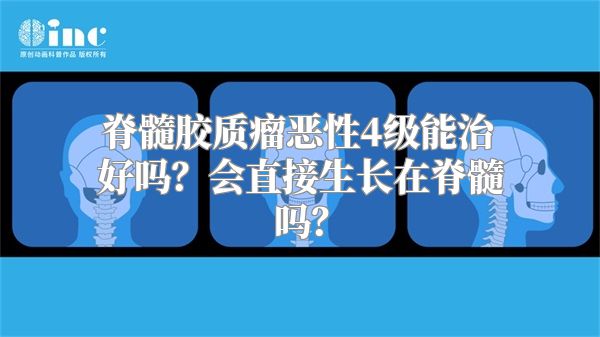 脊髓胶质瘤恶性4级能治好吗？会直接生长在脊髓吗？