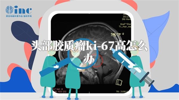 头部胶质瘤ki-67高怎么办