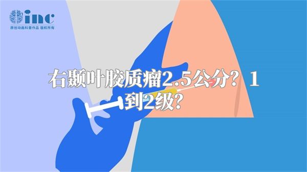 右颞叶胶质瘤2.5公分？1到2级？