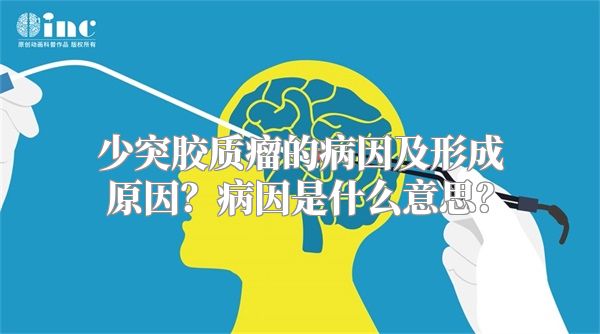 少突胶质瘤的病因及形成原因？病因是什么意思？