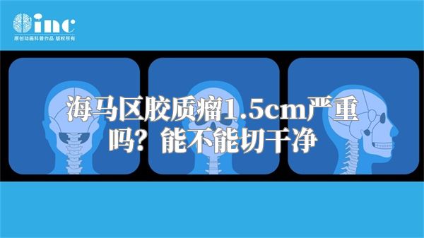 海马区胶质瘤1.5cm严重吗？能不能切干净