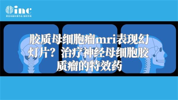 胶质母细胞瘤mri表现幻灯片？治疗神经母细胞胶质瘤的特效药