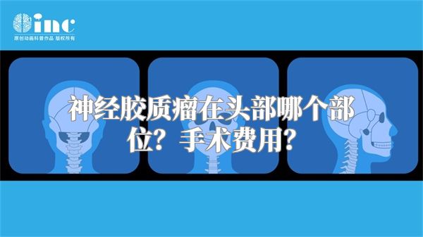 神经胶质瘤在头部哪个部位？手术费用？