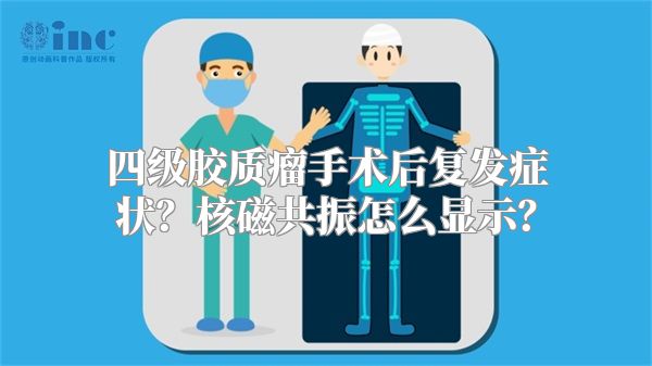 四级胶质瘤手术后复发症状？核磁共振怎么显示？