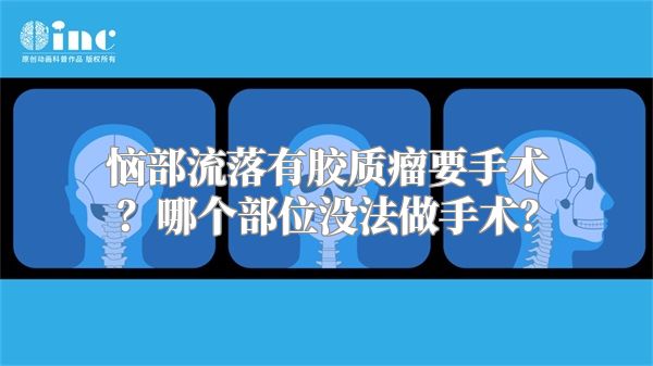 恼部流落有胶质瘤要手术？哪个部位没法做手术？