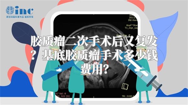 胶质瘤二次手术后又复发？基底胶质瘤手术多少钱费用？