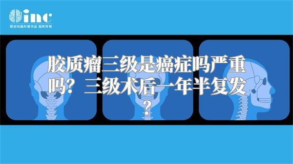 胶质瘤三级是癌症吗严重吗？三级术后一年半复发？