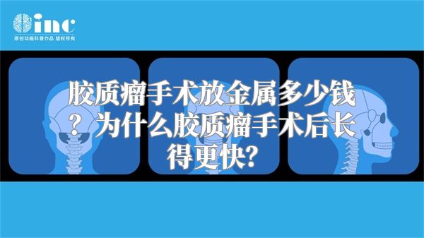 胶质瘤手术放金属多少钱？为什么胶质瘤手术后长得更快？