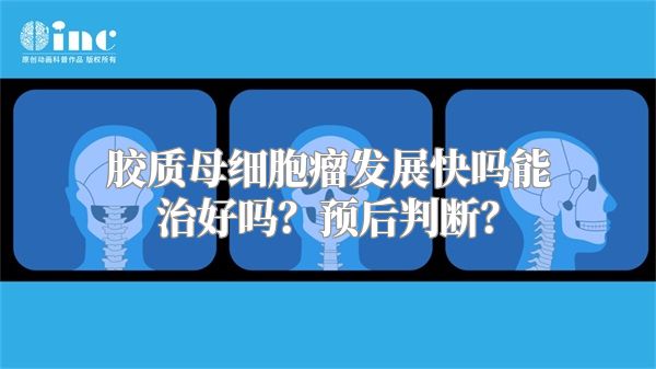 胶质母细胞瘤发展快吗能治好吗？预后判断？