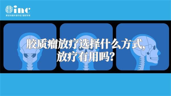 胶质瘤放疗选择什么方式，放疗有用吗？