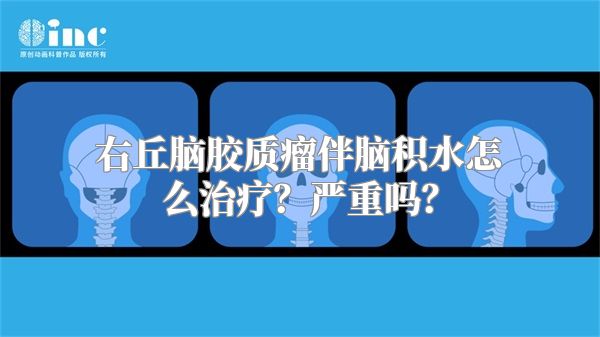 右丘脑胶质瘤伴脑积水怎么治疗？严重吗？