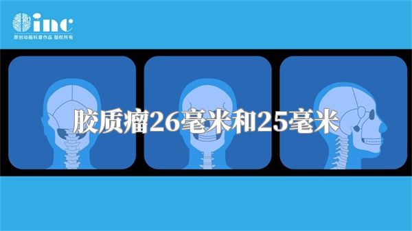 胶质瘤26毫米和25毫米