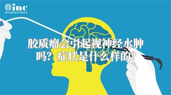 胶质瘤会引起视神经水肿吗？症状是什么样的？