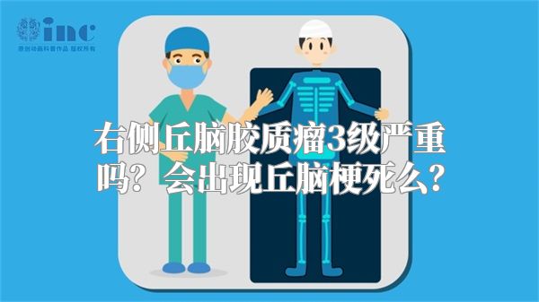 右侧丘脑胶质瘤3级严重吗？会出现丘脑梗死么？