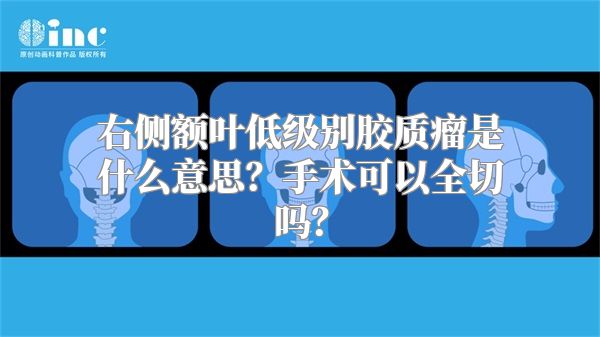 右侧额叶低级别胶质瘤是什么意思？手术可以全切吗？