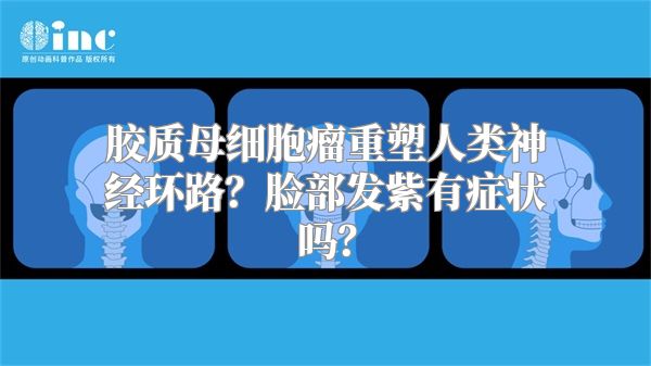 胶质母细胞瘤重塑人类神经环路？脸部发紫有症状吗？