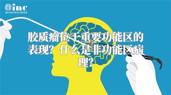 胶质瘤位于重要功能区的表现？什么是非功能区病理？