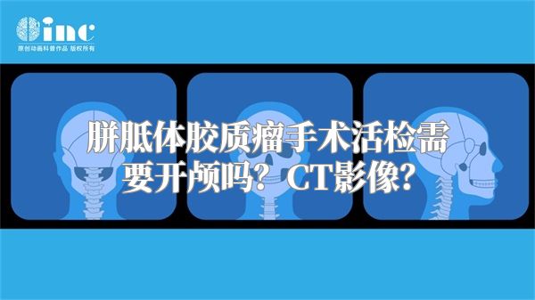 胼胝体胶质瘤手术活检需要开颅吗？CT影像？