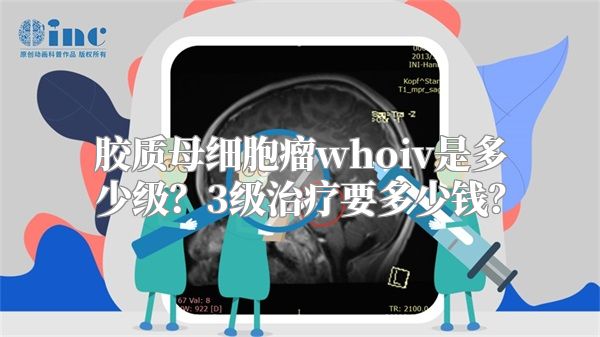 胶质母细胞瘤whoiv是多少级？3级治疗要多少钱？