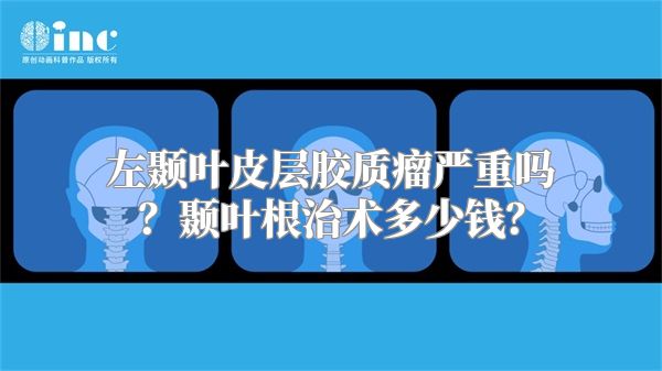 左颞叶皮层胶质瘤严重吗？颞叶根治术多少钱？