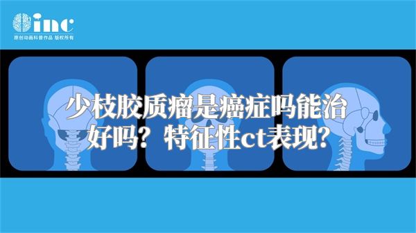 少枝胶质瘤是癌症吗能治好吗？特征性ct表现？