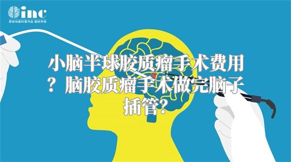 小脑半球胶质瘤手术费用？脑胶质瘤手术做完脑子插管？