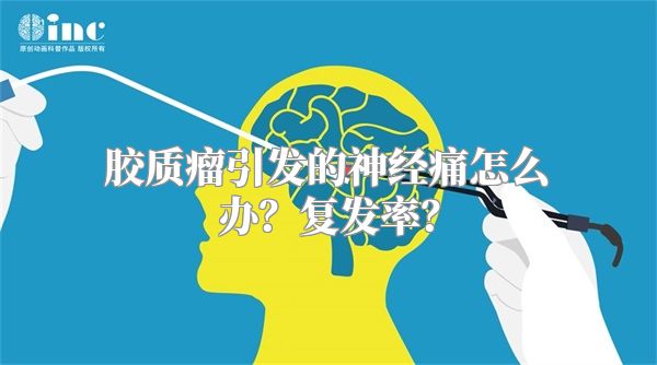 胶质瘤引发的神经痛怎么办？复发率？