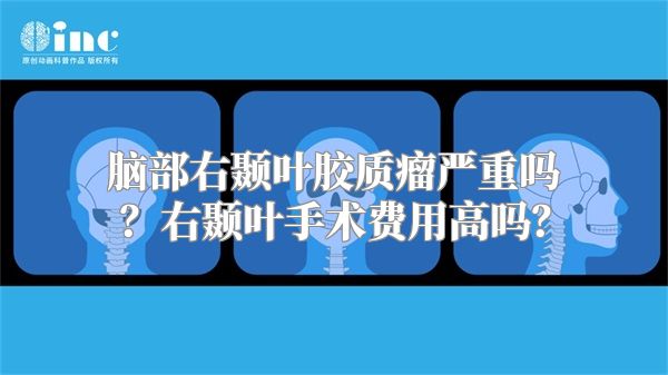 脑部右颞叶胶质瘤严重吗？右颞叶手术费用高吗？