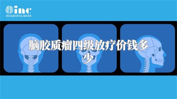 脑胶质瘤四级放疗价钱多少