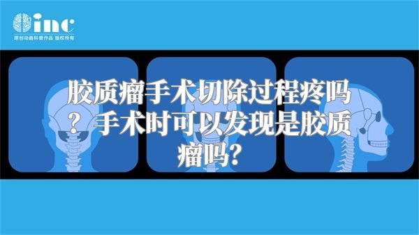 胶质瘤手术切除过程疼吗？手术时可以发现是胶质瘤吗？