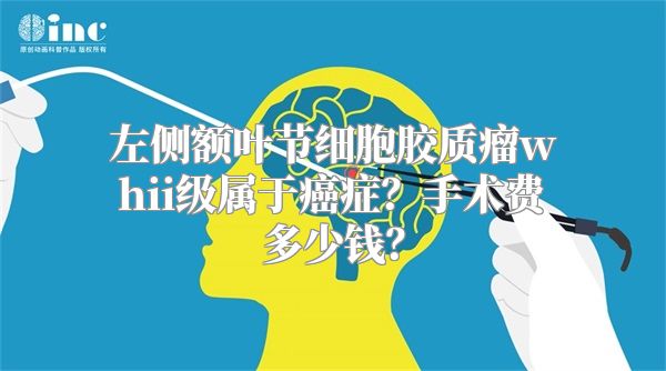 左侧额叶节细胞胶质瘤whii级属于癌症？手术费多少钱？