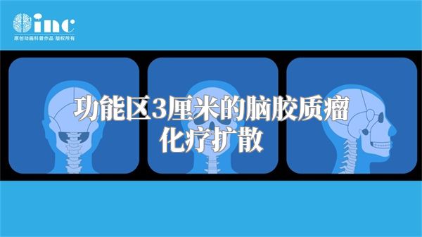 功能区3厘米的脑胶质瘤化疗扩散