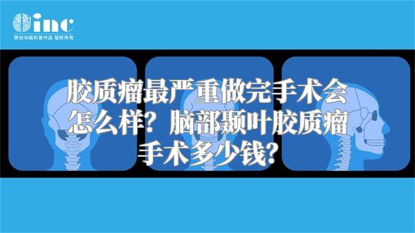 胶质瘤最严重做完手术会怎么样？脑部颞叶胶质瘤手术多少钱？