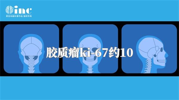 胶质瘤ki-67约10