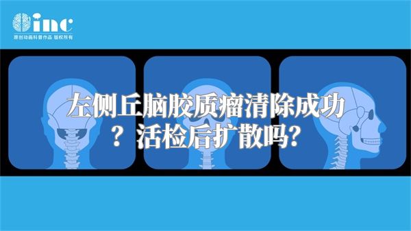 左侧丘脑胶质瘤清除成功？活检后扩散吗？