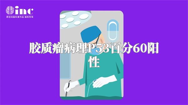 胶质瘤病理P53百分60阳性