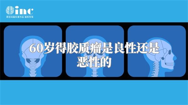 60岁得胶质瘤是良性还是恶性的