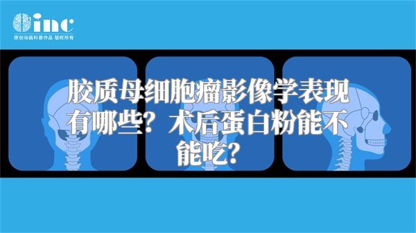 胶质母细胞瘤影像学表现有哪些？术后蛋白粉能不能吃？