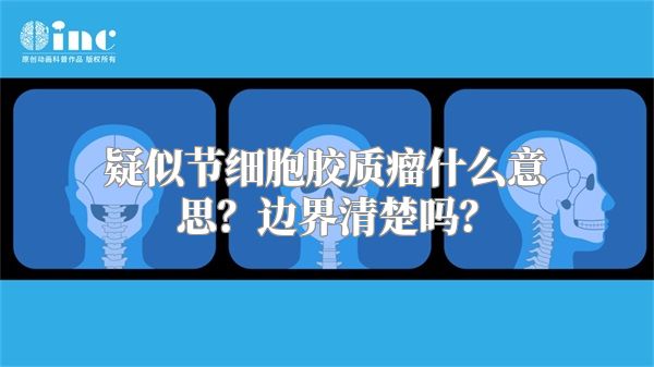 疑似节细胞胶质瘤什么意思？边界清楚吗？