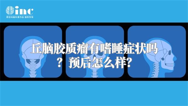 丘脑胶质瘤有嗜睡症状吗？预后怎么样？