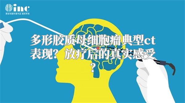 多形胶质母细胞瘤典型ct表现？放疗后的真实感受？