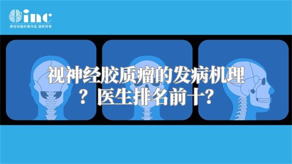 视神经胶质瘤的发病机理？医生排名前十？