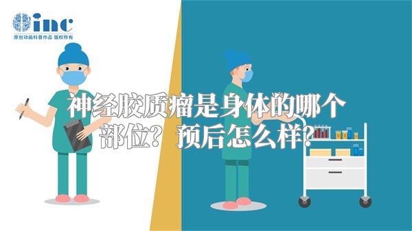 神经胶质瘤是身体的哪个部位？预后怎么样？