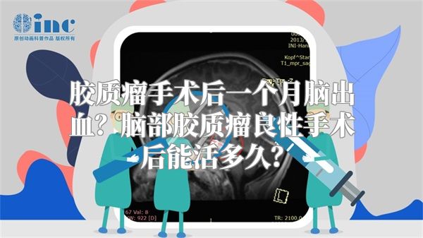 胶质瘤手术后一个月脑出血？脑部胶质瘤良性手术后能活多久？