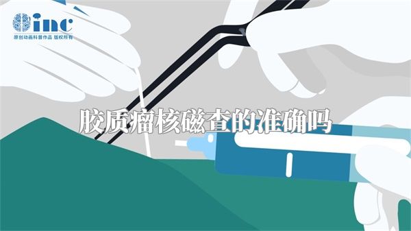 胶质瘤核磁查的准确吗