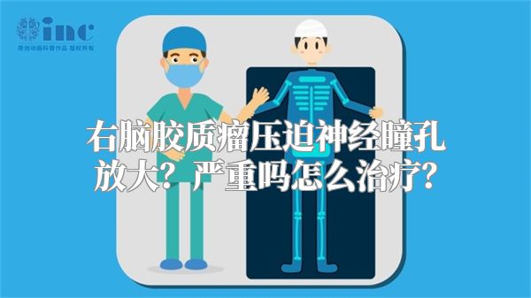 右脑胶质瘤压迫神经瞳孔放大？严重吗怎么治疗？