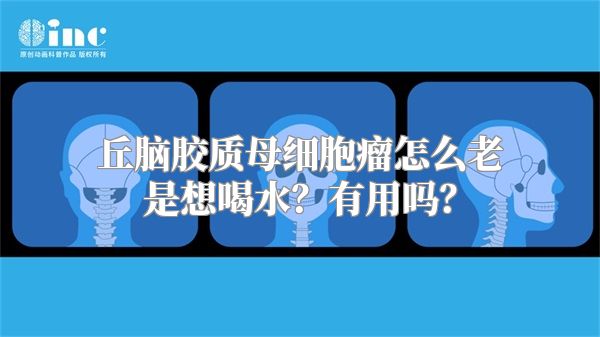 丘脑胶质母细胞瘤怎么老是想喝水？有用吗？