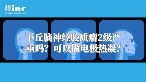 下丘脑神经胶质瘤2级严重吗？可以做电极热凝？