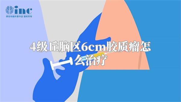 4级丘脑区6cm胶质瘤怎么治疗