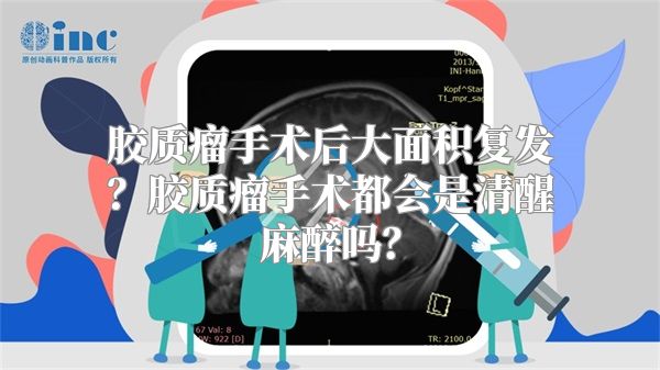 胶质瘤手术后大面积复发？胶质瘤手术都会是清醒麻醉吗？